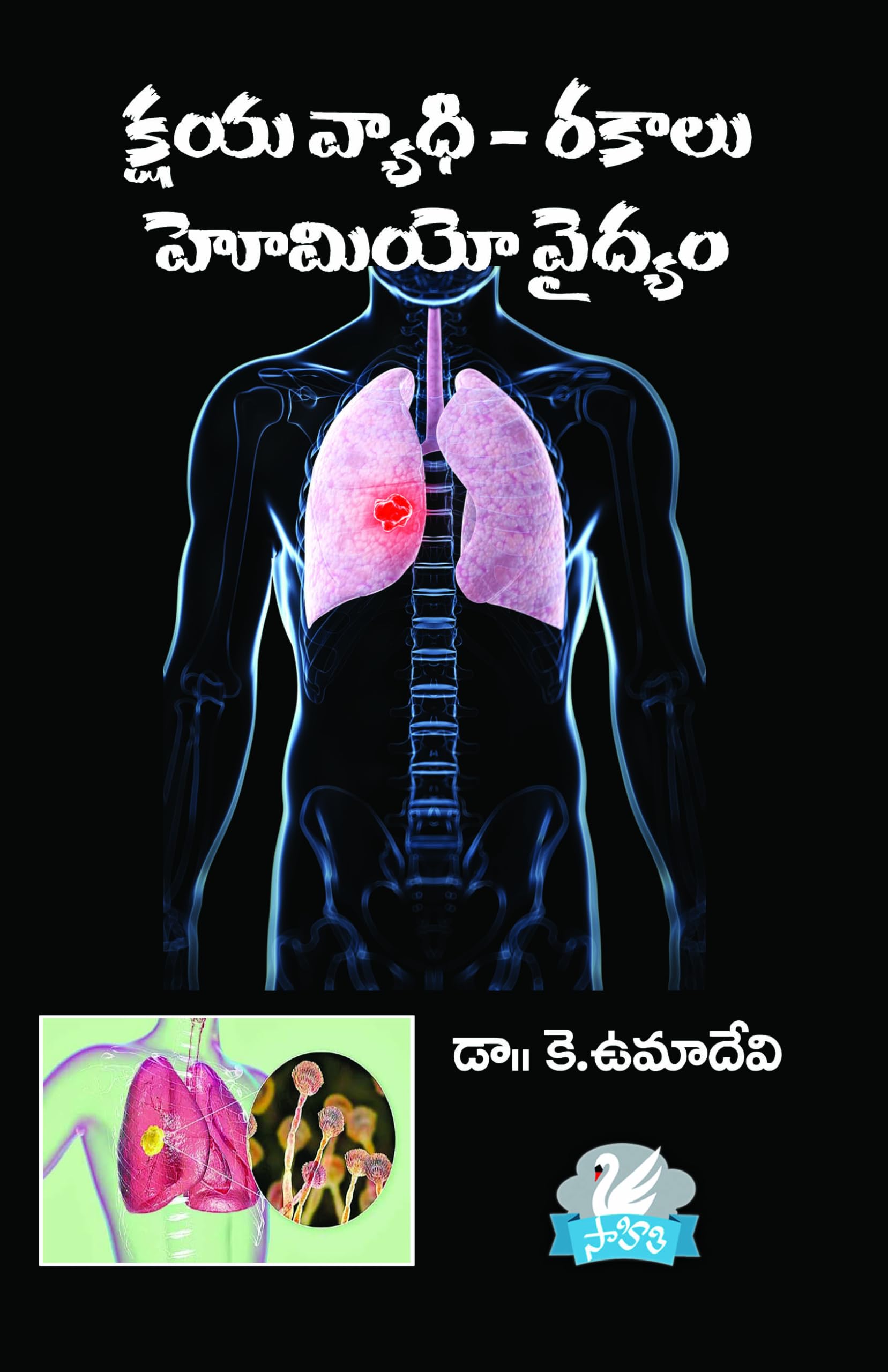 Kshya vyadhi-Rakalu Homeo vydhyam